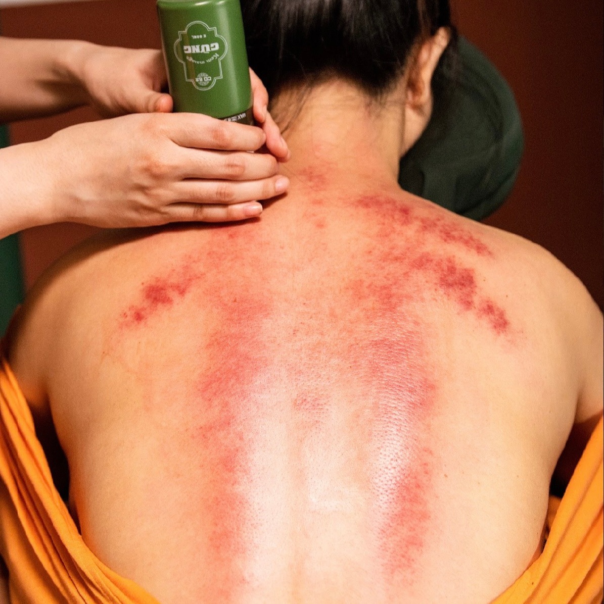 Cứu ấm giải hàn