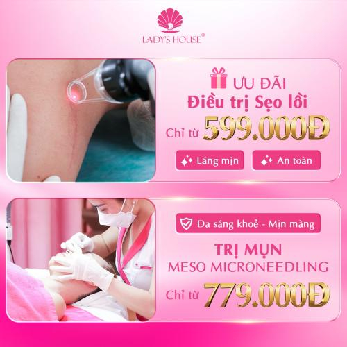 Chi phí được minh bạch và tối ưu