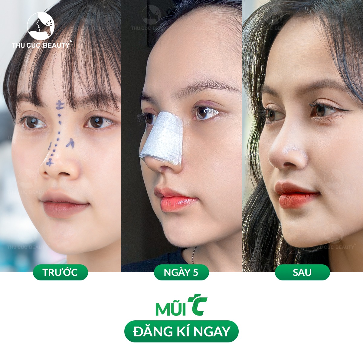 Thẩm mỹ mặt