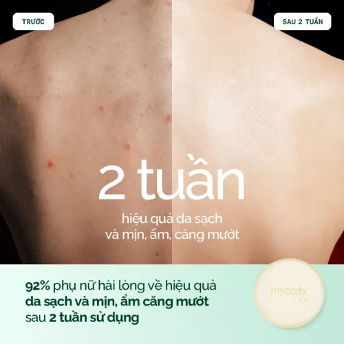 Xà Phòng Sữa Dê Hữu Cơ Pháp My Body VIP. Dịu Nhẹ, Dưỡng Ẩm Cho Mọi Loại Da | Organic 100g