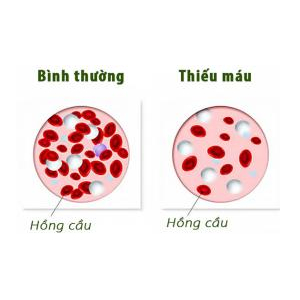 6. Phòng bệnh thiếu máu do thiếu sắt