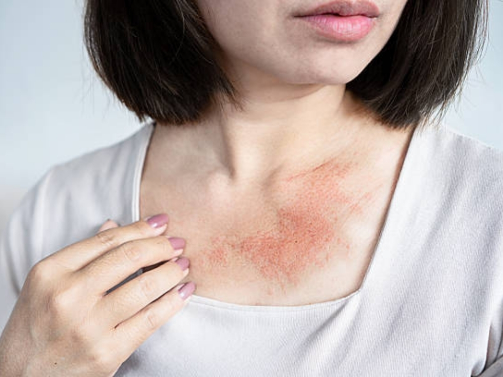 Kích ứng da và mắt