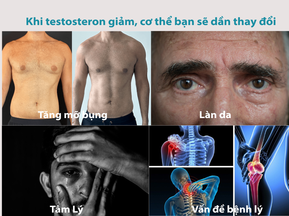 Biểu hiện của "giai đoạn mãn" ở nam giới không rõ ràng như phụ nữ.