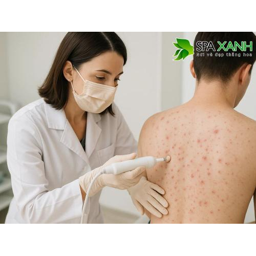 3. Cách cải thiện và ngăn ngừa mụn ở lưng tại nhà