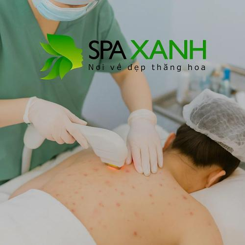 Mụn Lưng: Nguyên Nhân, Dấu Hiệu Và Cách Điều Trị Hiệu Quả Từ Gốc