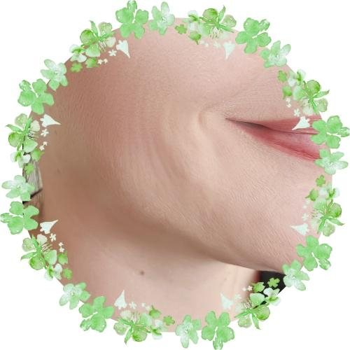 Nâng cơ xóa nhăn