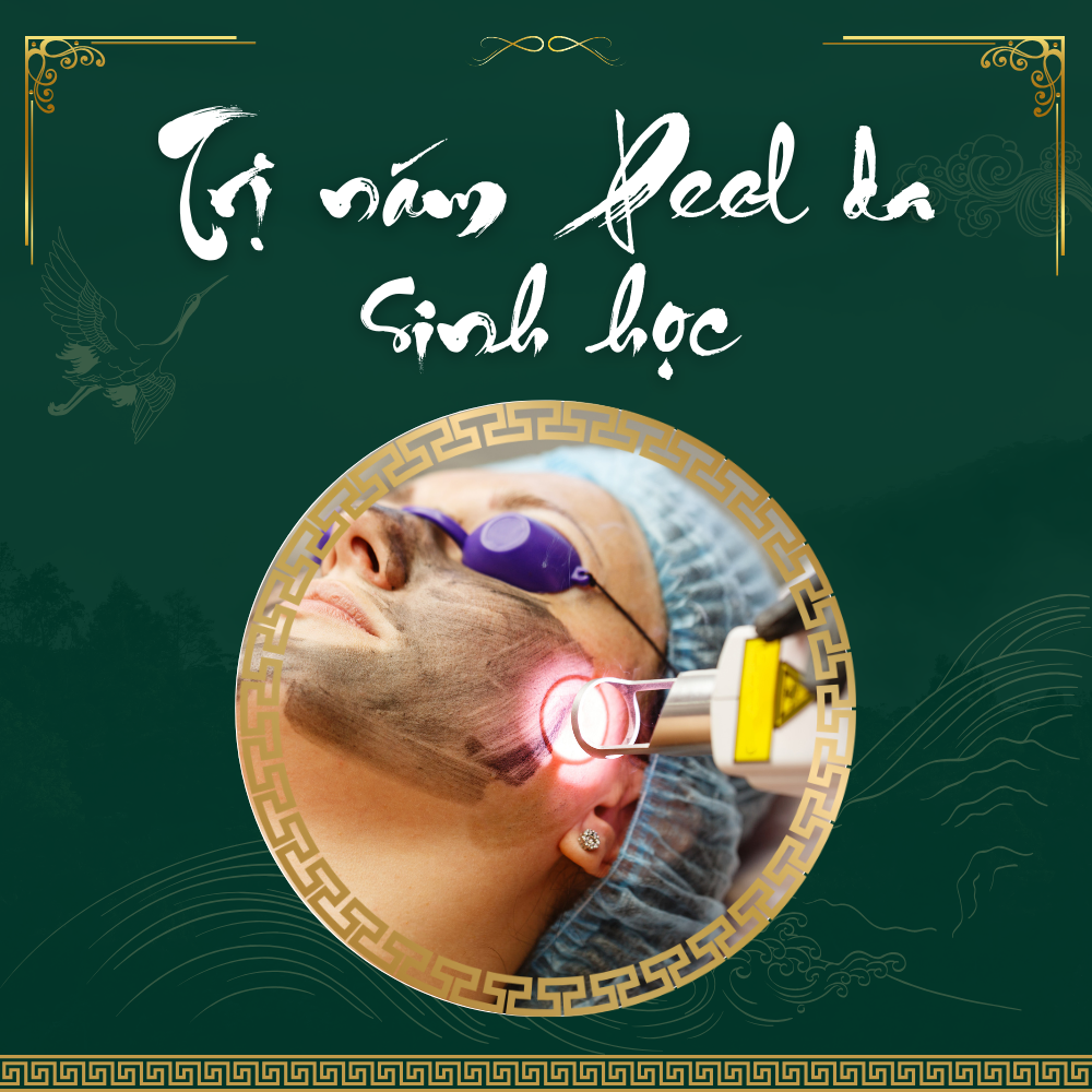 Lột da hóa học