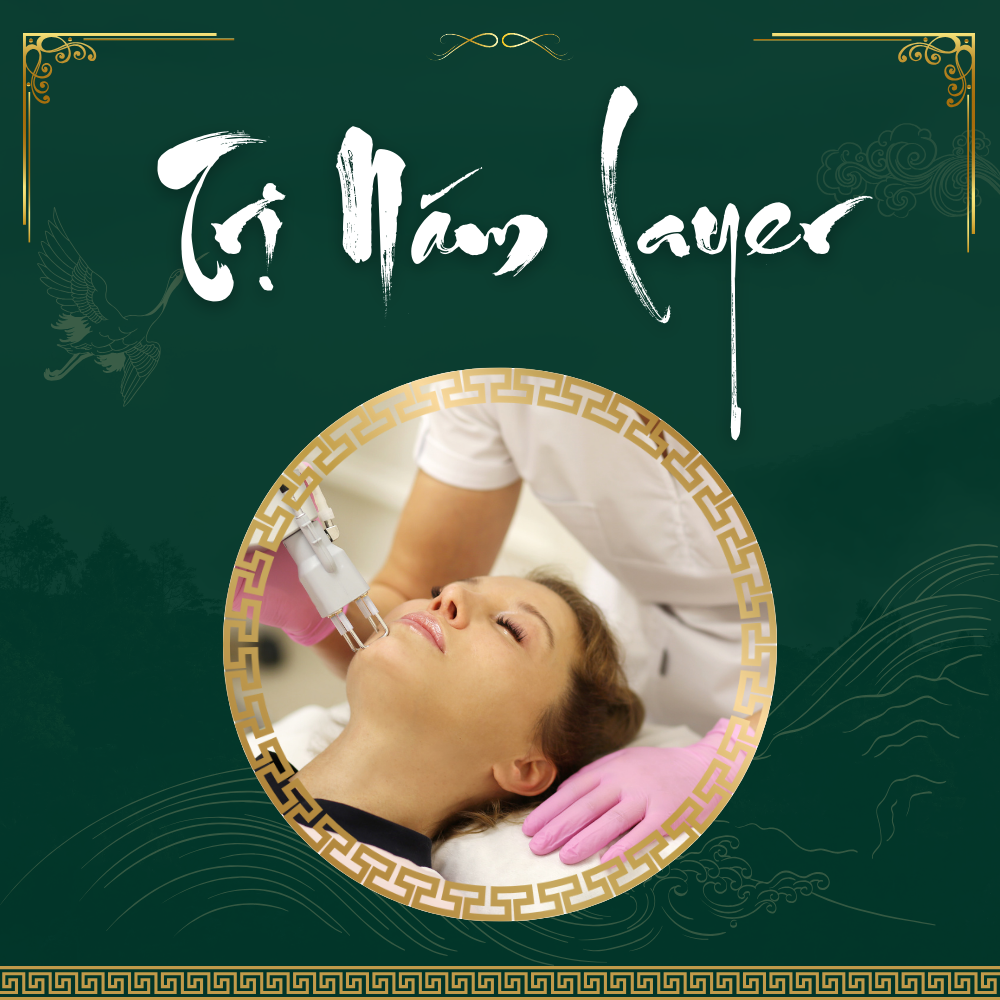 Trị nám bằng công nghệ laser