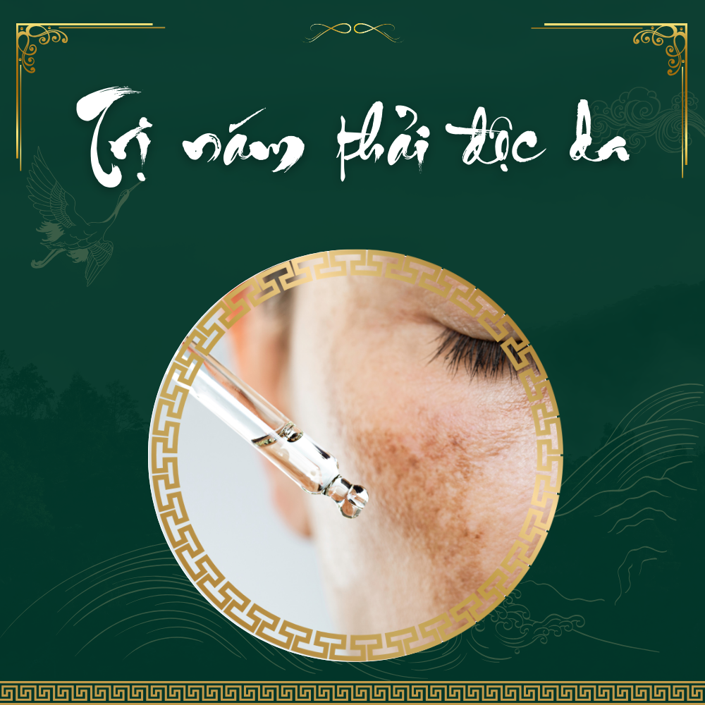 Khi điều trị nám da cần lưu ý gì?