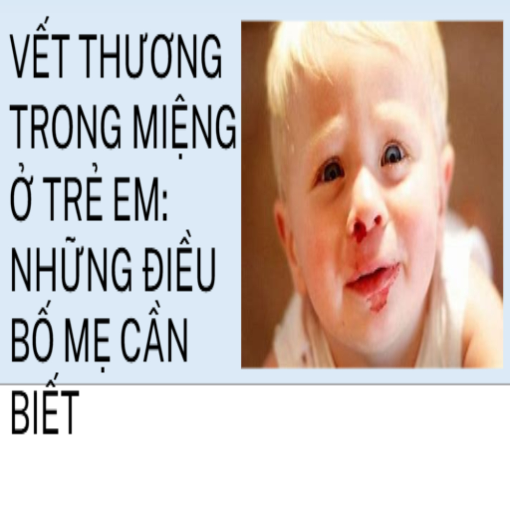 Xử Lý Vết Thương Trong Miệng Ở Trẻ Em - Những Điều Bố Mẹ Cần Biết