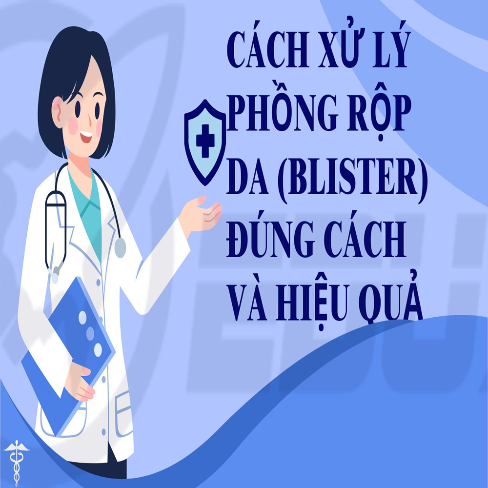 Cách Xử Lý Phồng Rộp Da (Blister) Đúng Cách Và Hiệu Quả