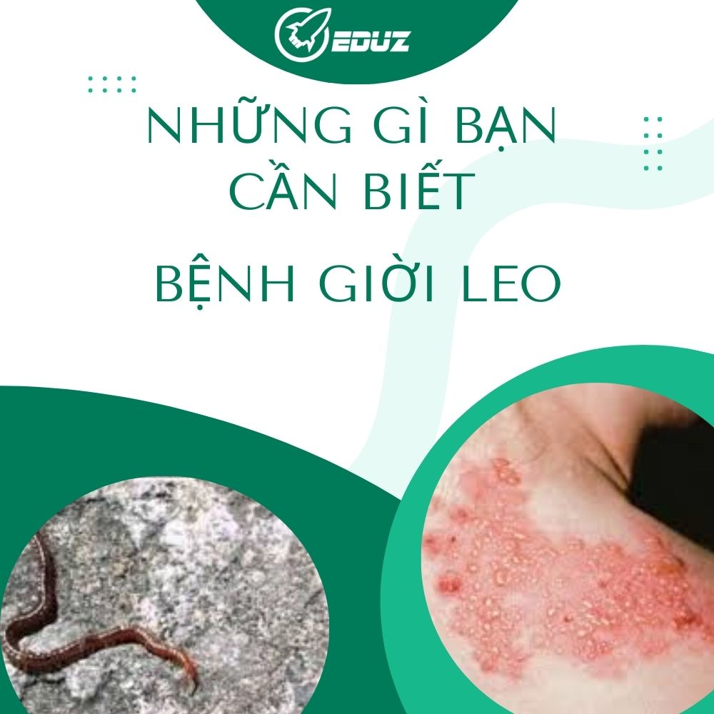 Những Gì Bạn Cần Biết Về Bệnh Giời Leo