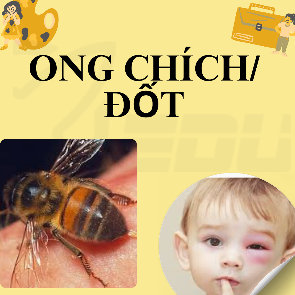 Ong chích/ đốt