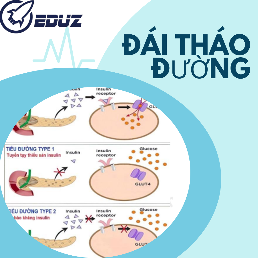 Trang 214 - Bệnh Đái Tháo Đường: Nguyên Nhân, Phân Loại và Cách Xử Lý Tăng Đường Huyết