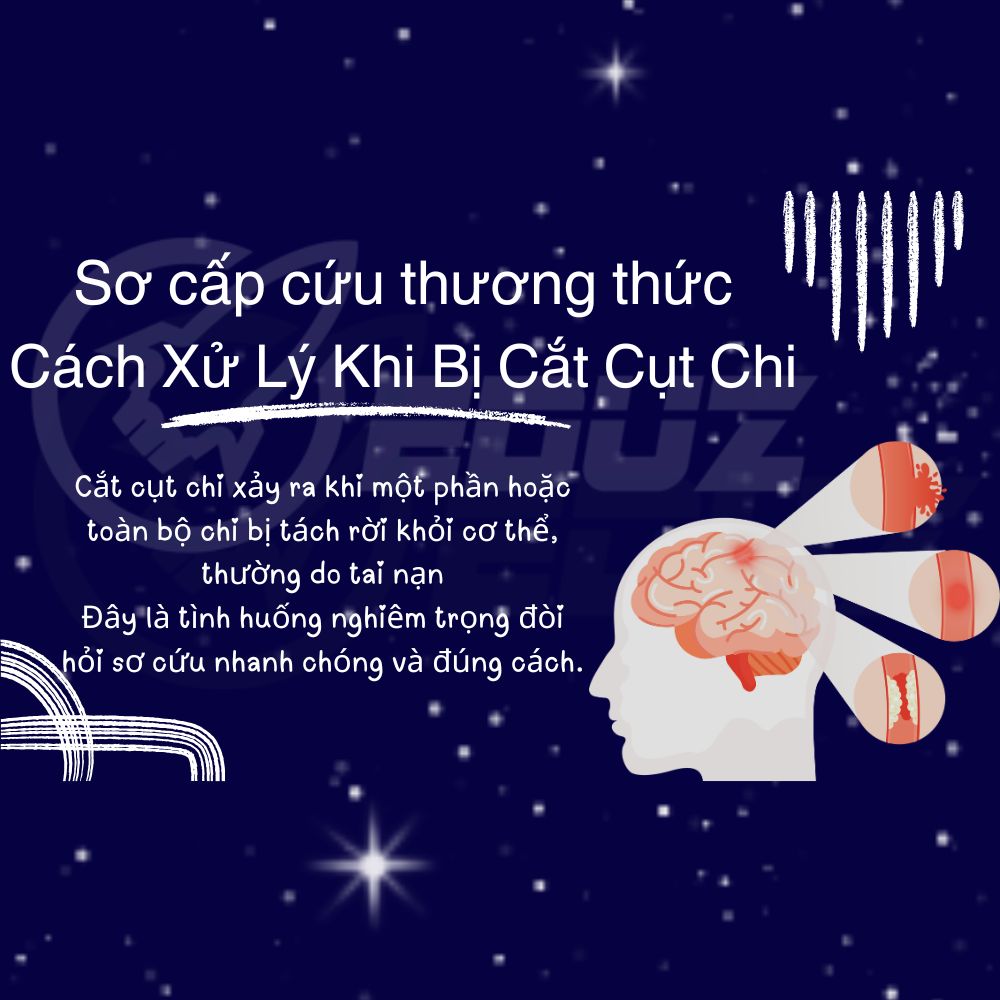 Cách Xử Lý Khi Bị Cắt Cụt Chi