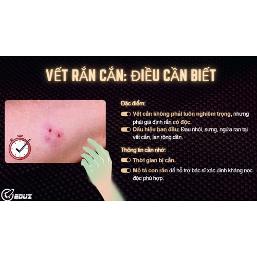 1. Đặc điểm vết rắn cắn