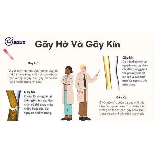 4. Gãy hở và gãy kín