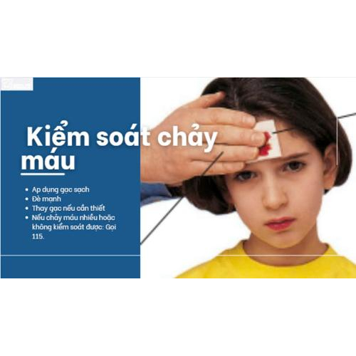 Kiểm soát chảy máu