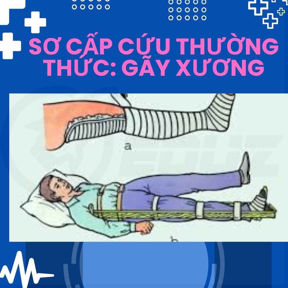 Sơ Cấp Cứu Thường Thức: Gãy Xương