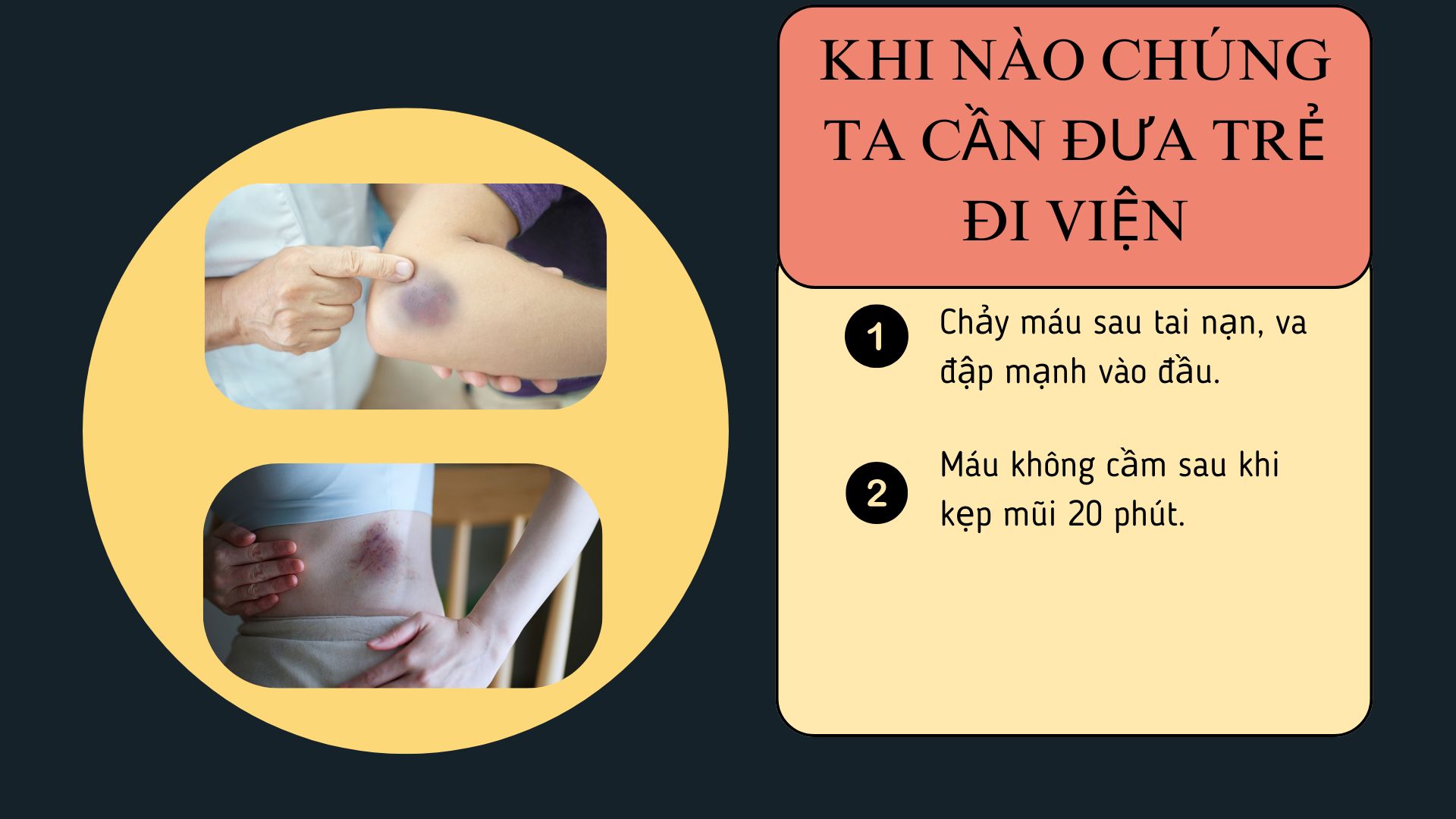 Khi Nào Cần Đưa Trẻ Đi Bệnh Viện?