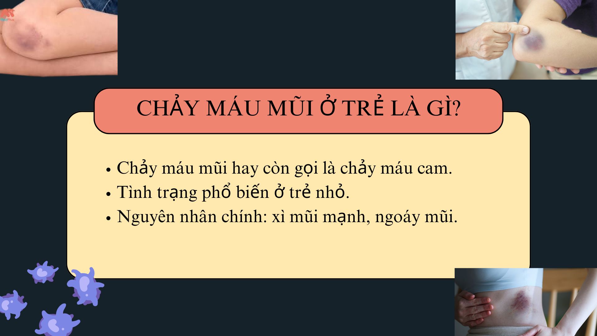 Chảy Máu mũi Ở Trẻ Là Gì?
