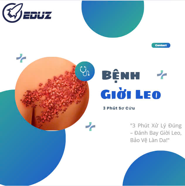 3 Phút Sơ Cứu Bệnh Giời Leo