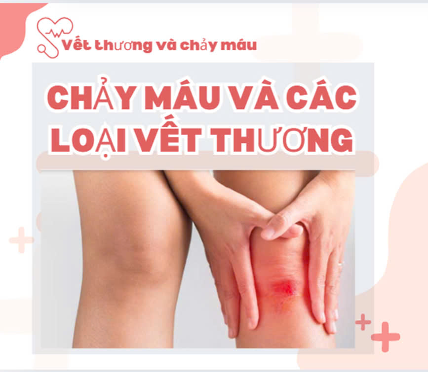 CHẢY MÁU VÀ CÁC LOẠI VẾT THƯƠNG