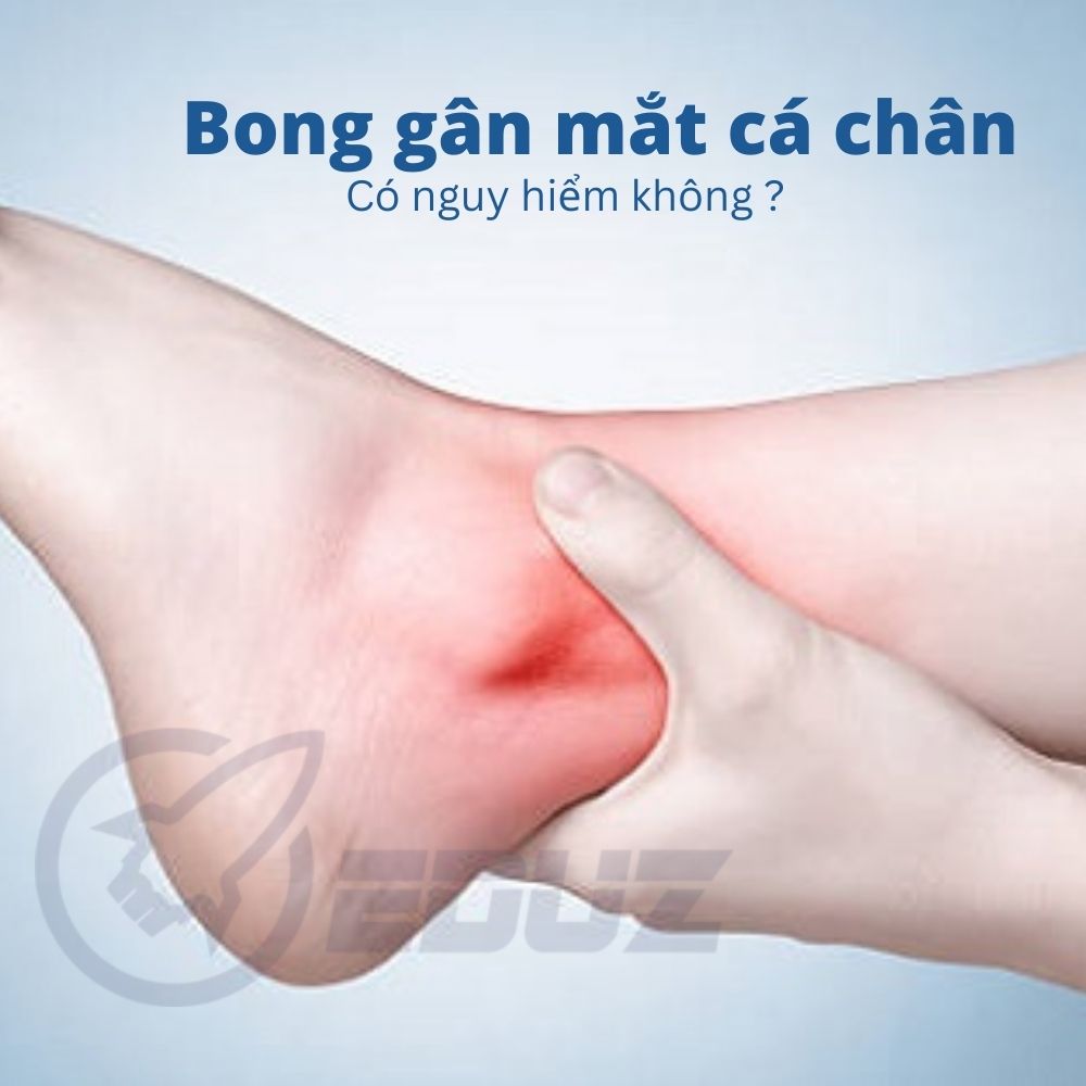 Nguyên Nhân, Dấu Hiệu Và Cách Xử Lý Chấn Thương Mắt Cá