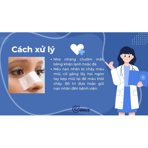 8. Cách xử lý chấn thương xương mũi và xương gò má