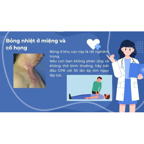 6. Bỏng nhiệt ở miệng và cổ họng