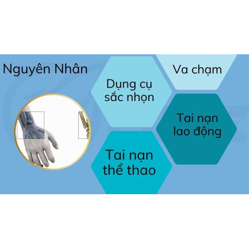 3.Nguyên nhân