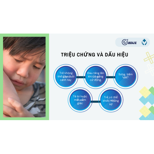 2. Triệu chứng và dấu hiệu