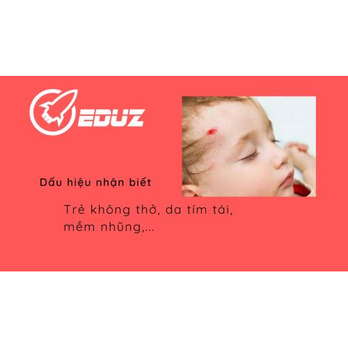 II. Các dấu hiệu nhận biết trẻ sơ sinh ngưng thở