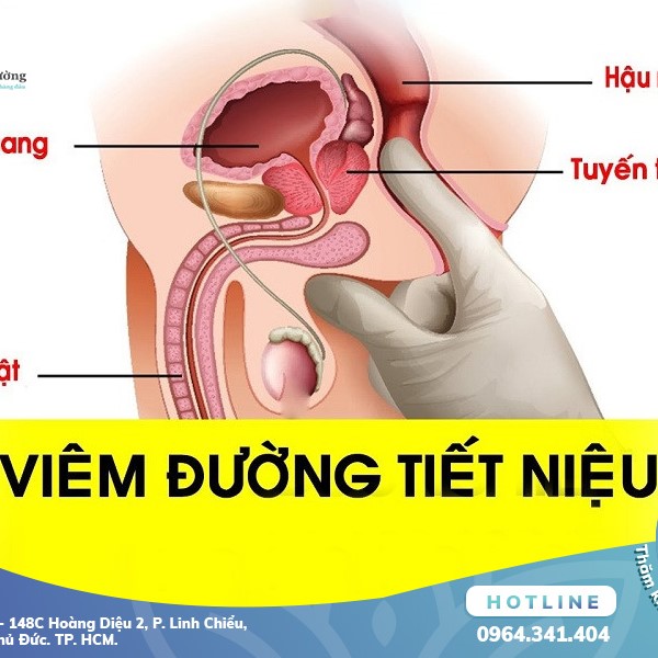 Viêm Đường Tiết Niệu: Định Nghĩa, Nguyên Nhân, Biểu Hiện Là Gì?