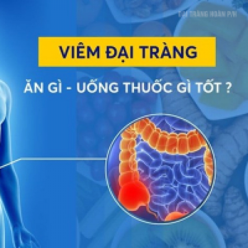 Cảnh báo triệu chứng viêm đại tràng – Nguyên nhân, cách chữa