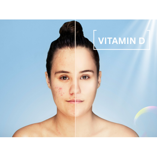 Điều trị mụn trứng cá